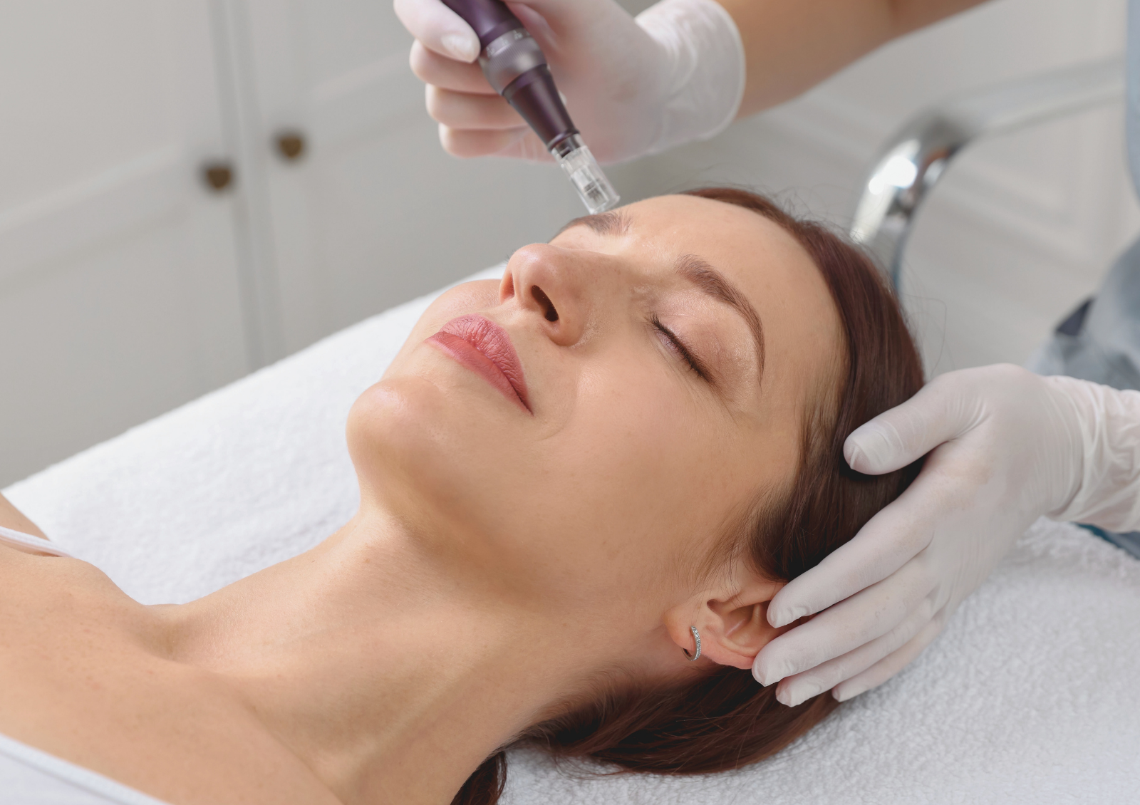 How Long Does Microneedling Take to Work? Realistic Results by Age & Skin Type